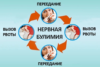 Лечение булимии в Дыгулыбей